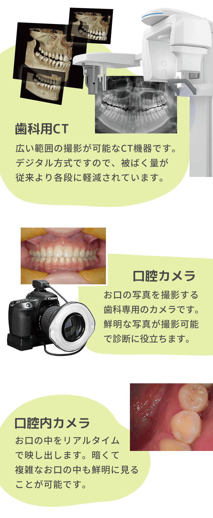 CT、口腔カメラ、口腔内カメラ